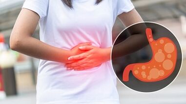 nutrition rules for gastritis of the stomach